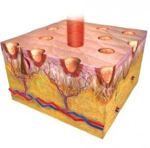 epiderme