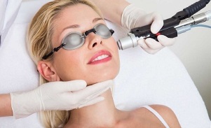 Como se realiza o procedemento de rexuvenecemento facial con láser