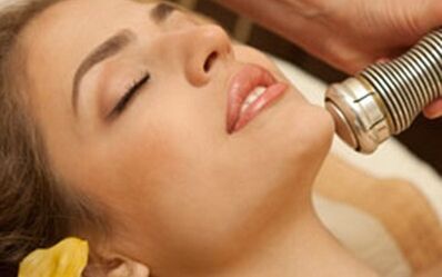 Vantaxes e inconvenientes do rexuvenecemento cutáneo con láser fraccionado