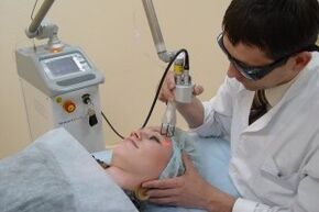 Procedemento de rexuvenecemento da pel facial con láser